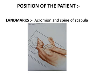 POSITION OF THE PATIENT :-
LANDMARKS :- Acromion and spine of scapula
 