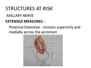 STRUCTURES AT RISK
AXILLARY NERVE
EXTENSILE MEASURES :-
Proximal Extension -incision superiorly and
medially across the acromion
 