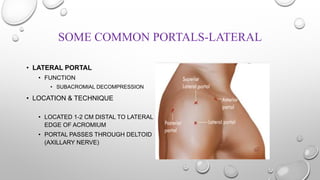 SOME COMMON PORTALS-LATERAL
• LATERAL PORTAL
• FUNCTION
• SUBACROMIAL DECOMPRESSION
• LOCATION & TECHNIQUE
• LOCATED 1-2 CM DISTAL TO LATERAL
EDGE OF ACROMIUM
• PORTAL PASSES THROUGH DELTOID
(AXILLARY NERVE)
 