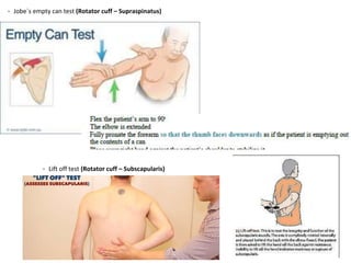 - Jobe`s empty can test (Rotator cuff – Supraspinatus)
- Lift off test (Rotator cuff – Subscapularis)