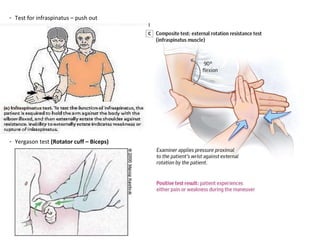 - Test for infraspinatus – push out
- Yergason test (Rotator cuff – Biceps)