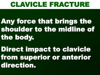 CLAVICLE FRACTURE
Any force that brings the
shoulder to the midline of
the body.
Direct impact to clavicle
from superior or anterior
direction.
 