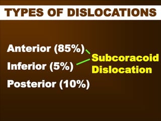 TYPES OF DISLOCATIONS
Anterior (85%)
Inferior (5%)
Posterior (10%)
Subcoracoid
Dislocation
 