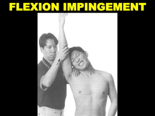 FLEXION IMPINGEMENT
 