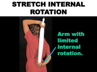 STRETCH INTERNAL
ROTATION
Arm with
limited
internal
rotation.
 