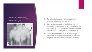 Shoulder.pptxmuscoloskeletalaaaaaaaaaaaa | PPTX
