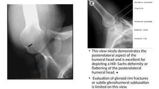 Comprehensive Radiographic Views for Shoulder Joint Evaluation and ...