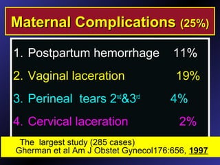 1. Postpartum hemorrhage 11%
2. Vaginal laceration 19%
3. Perineal tears 2nd
&3rd
4%
4. Cervical laceration 2%
Maternal ComplicationsMaternal Complications (25%)(25%)
The largest study (285 cases)
Gherman et al Am J Obstet Gynecol176:656, 1997
 