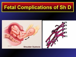 Release techniquesFetal Complications of Sh DFetal Complications of Sh D
 