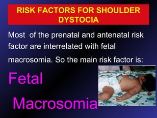 RISK FACTORS FOR SHOULDER
DYSTOCIA
Most of the prenatal and antenatal risk
factor are interrelated with fetal
macrosomia. So the main risk factor is:
Fetal
Macrosomia
 