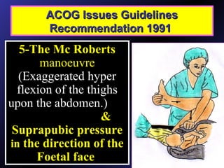 ACOG Issues GuidelinesACOG Issues Guidelines
Recommendation 1991Recommendation 1991
.
5-The Mc Roberts
manoeuvre
(Exaggerated hyper
flexion of the thighs
upon the abdomen.)
&
Suprapubic pressure
in the direction of the
Foetal face
 