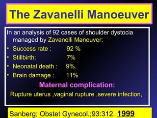 Zavanelli maneuver
In an analysis of 92 cases of shoulder dystocia
managed by Zavanelli Maneuver:
• Success rate : 92 %
• Stillbirth: 7%
• Neonatal death : 9%.
• Brain damage : 11%
Maternal complication:
Rupture uterus ,vaginal rupture ,severe infection,
The Zavanelli Manoeuver
Sanberg; Obstet Gynecol.;93:312. 1999
 