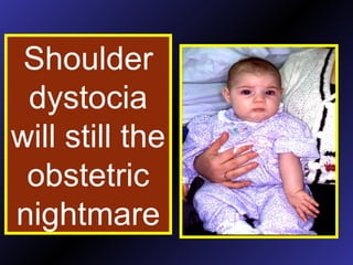 Shoulder
dystocia
will still the
obstetric
nightmare
 