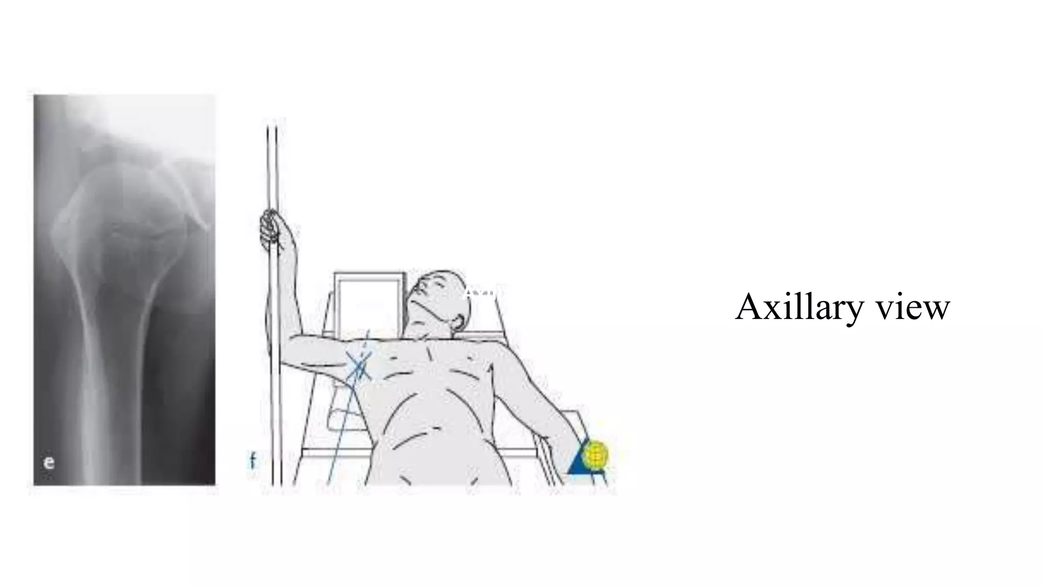 Axillary view
Axillary view
 