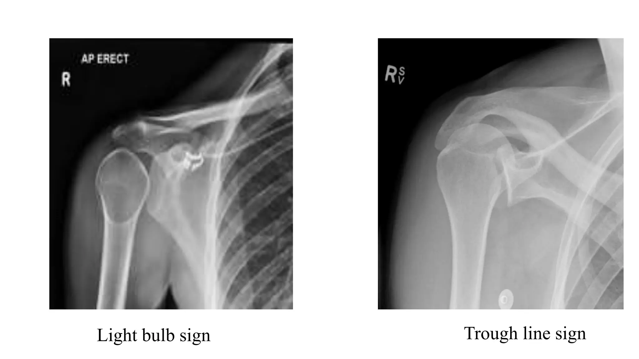 Light bulb sign Trough line sign
 