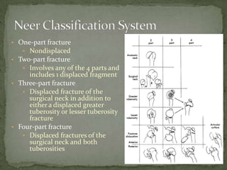 Nehr Classification Proximal Humerus Fracture | PPTX