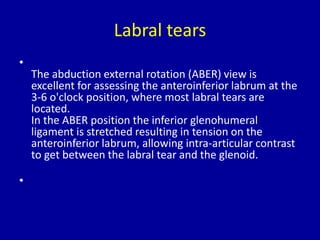 MRI of Shoulder anatomy | PPTX