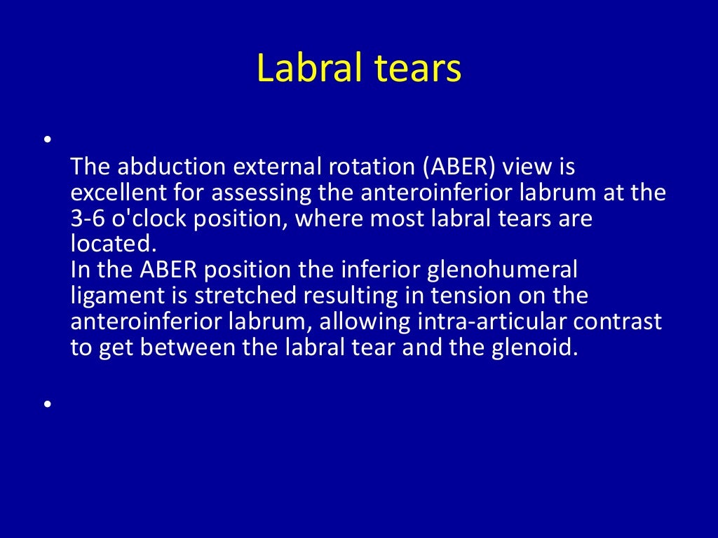 MRI of Shoulder anatomy