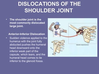 Humurus Dislocation shoulderanatomy-160501022628.pptx