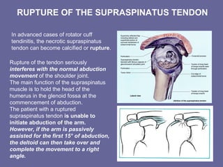 RUPTURE OF THE SUPRASPINATUS TENDON
In advanced cases of rotator cuff
tendinitis, the necrotic supraspinatus
tendon can become calcified or rupture.
Rupture of the tendon seriously
interferes with the normal abduction
movement of the shoulder joint.
The main function of the supraspinatus
muscle is to hold the head of the
humerus in the glenoid fossa at the
commencement of abduction.
The patient with a ruptured
supraspinatus tendon is unable to
initiate abduction of the arm.
However, if the arm is passively
assisted for the first 15° of abduction,
the deltoid can then take over and
complete the movement to a right
angle.
 