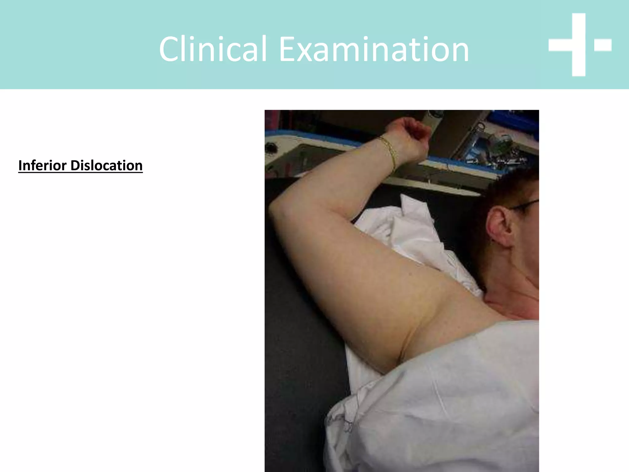 Clinical Examination
Inferior Dislocation
 