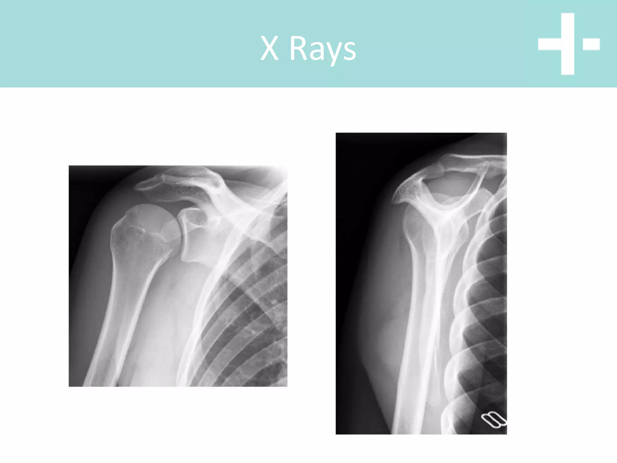 X Rays
 