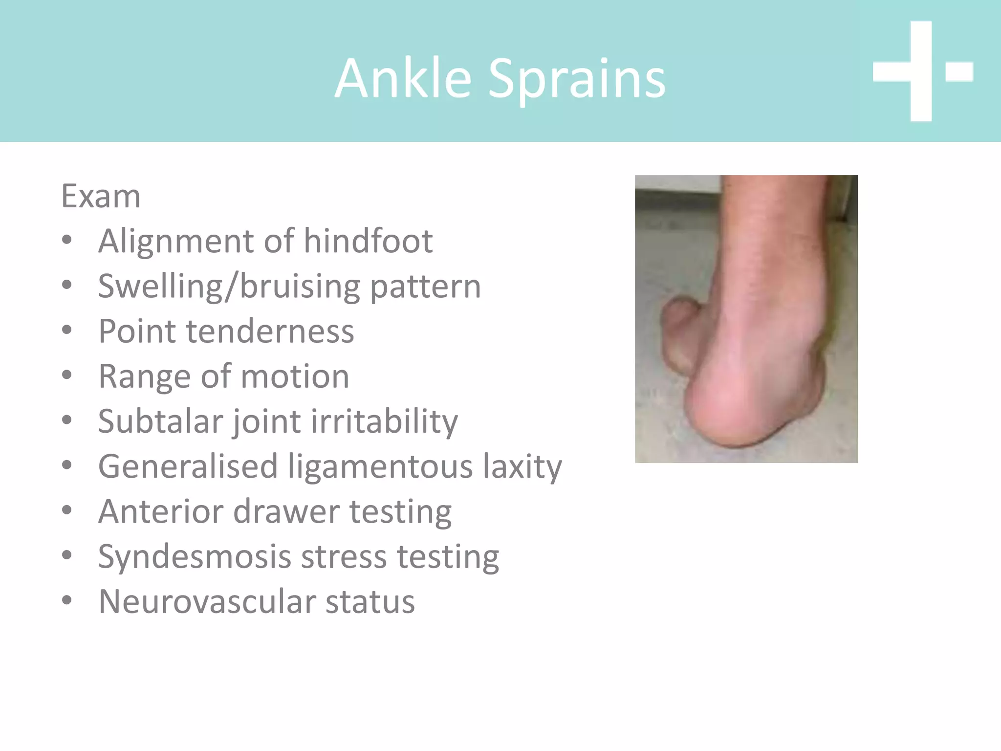Ankle Sprains
Exam
• Alignment of hindfoot
• Swelling/bruising pattern
• Point tenderness
• Range of motion
• Subtalar joint irritability
• Generalised ligamentous laxity
• Anterior drawer testing
• Syndesmosis stress testing
• Neurovascular status
 
