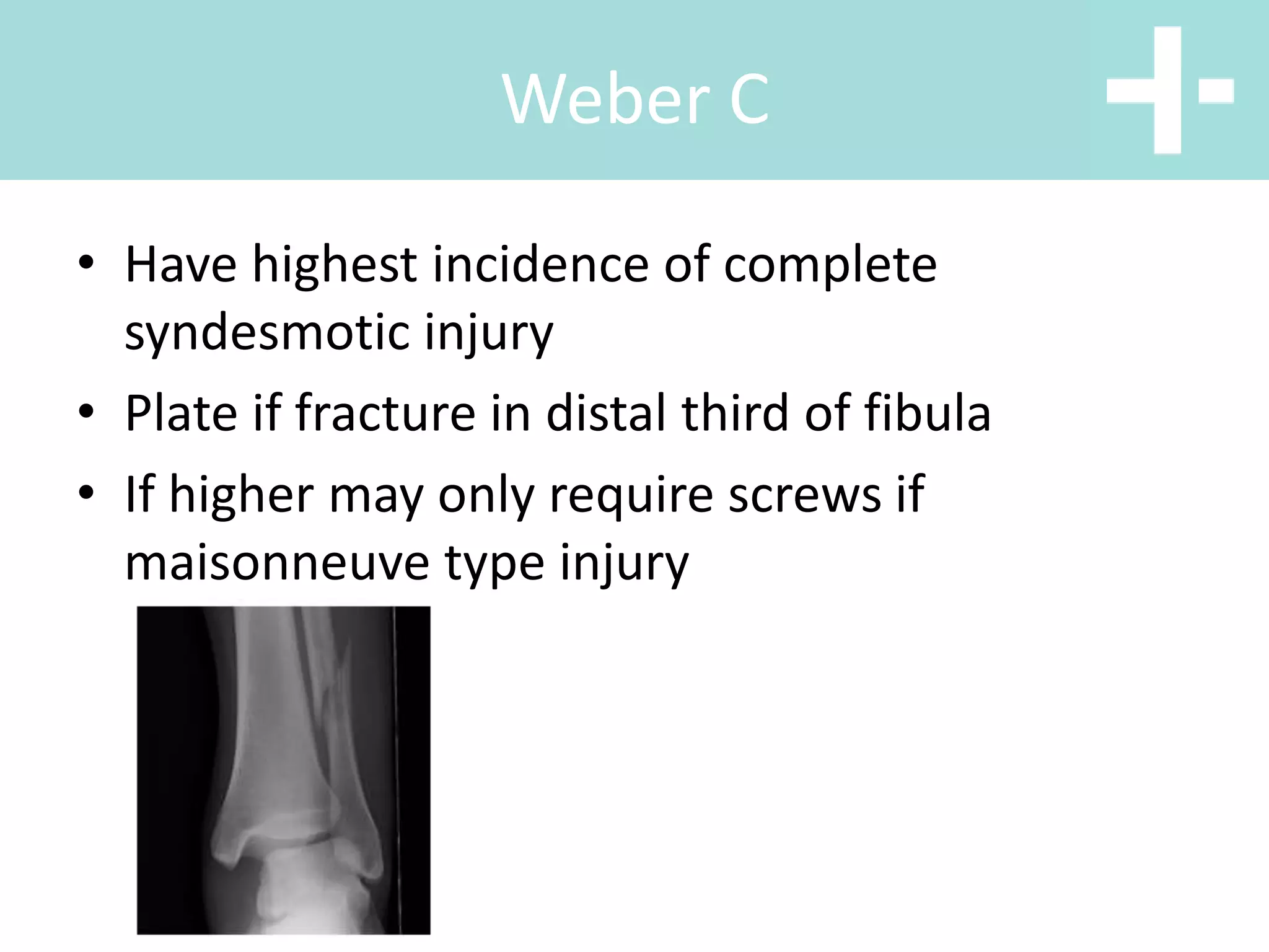 • Have highest incidence of complete
syndesmotic injury
• Plate if fracture in distal third of fibula
• If higher may only require screws if
maisonneuve type injury
Weber C
 