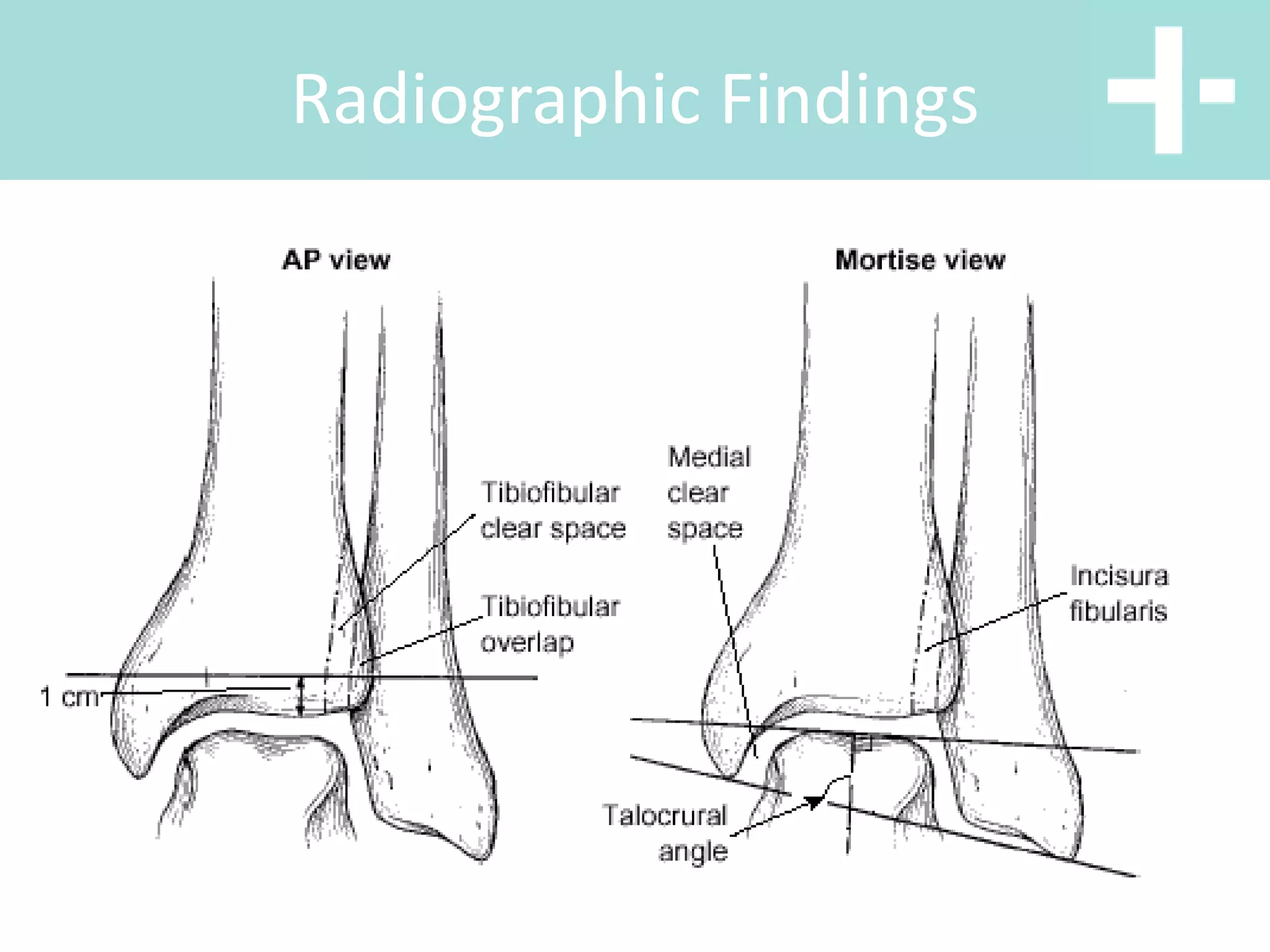 Radiographic Findings
 