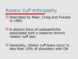 Rotator Cuff Arthropathy
 Described by Neer, Craig and Fukada
in 1983.
 A distinct form of osteoarthritis
associated with a massive chronic
rotator cuff tear.
 Generally, rotator cuff tears occur in
less than 10% of shoulders with OA
 