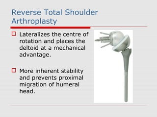 Reverse Total Shoulder
Arthroplasty
 Lateralizes the centre of
rotation and places the
deltoid at a mechanical
advantage.
 More inherent stability
and prevents proximal
migration of humeral
head.
 
