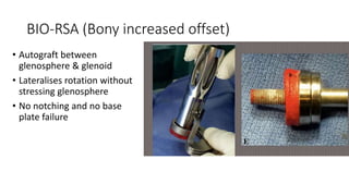 shoulder arthroplasty.pptx