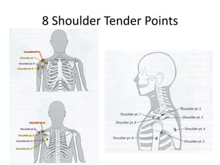 8 Shoulder Tender Points
 