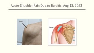 Acute Shoulder Pain Due to Bursitis: Aug 13, 2023
Pain
 