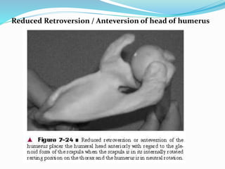 Retroversion Head Shoulder Complex(1).pptx