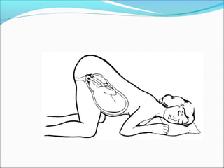 Shoulder  cord_presentation