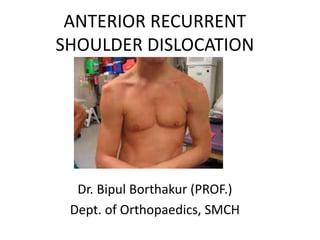 ANTERIOR RECURRENT
SHOULDER DISLOCATION
Dr. Bipul Borthakur (PROF.)
Dept. of Orthopaedics, SMCH
 