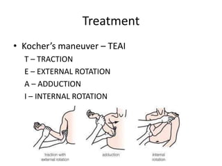 Kocher Maneuver Shoulder