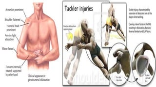 Tow Dislocation SHOULDER DISLOCATION-1.pptx