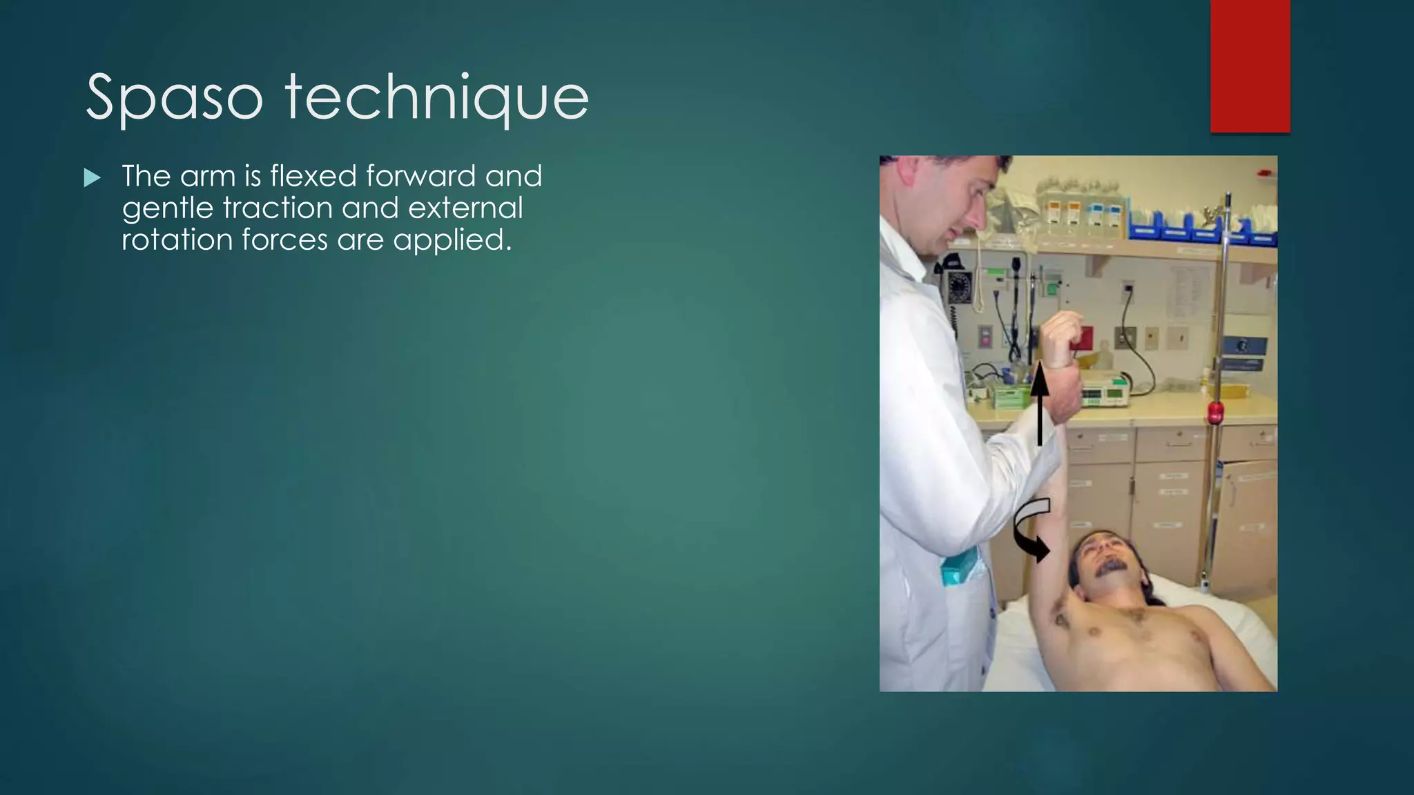 Shoulder dislocation | PPTX