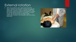External rotation 
 With the patient's arm adducted and the 
elbow flexed, the forearm is slowly and gently 
externally rotated. If pain or spasm is felt, the 
physician stops and allows the patient to relax. 
No longitudinal traction is necessary. In most 
cases, by the time the shoulder is fully 
externally rotated, the shoulder will have been 
reduced. 
 