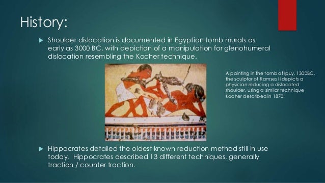 Shoulder Dislocation