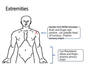 Extremities
tender, limit ROM shoulder,
Ruler and Dugar sign
positive , can palpate head
of humerus , Pinprick
sensory intact
Can flex/extend
elbow and finger ,
pinprick sensory
intact
 