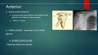 Anterior:
 Subcoracoid (anterior):
 Humeral head sits anterior and medial to the
glenoid, just inferior to the coracoid.
 ~ 60% of cases.
 PREGLENOID: Head lies in front of the
glenoid.
 SUBCLAVICULAR
: Head lies below the clavicle
 