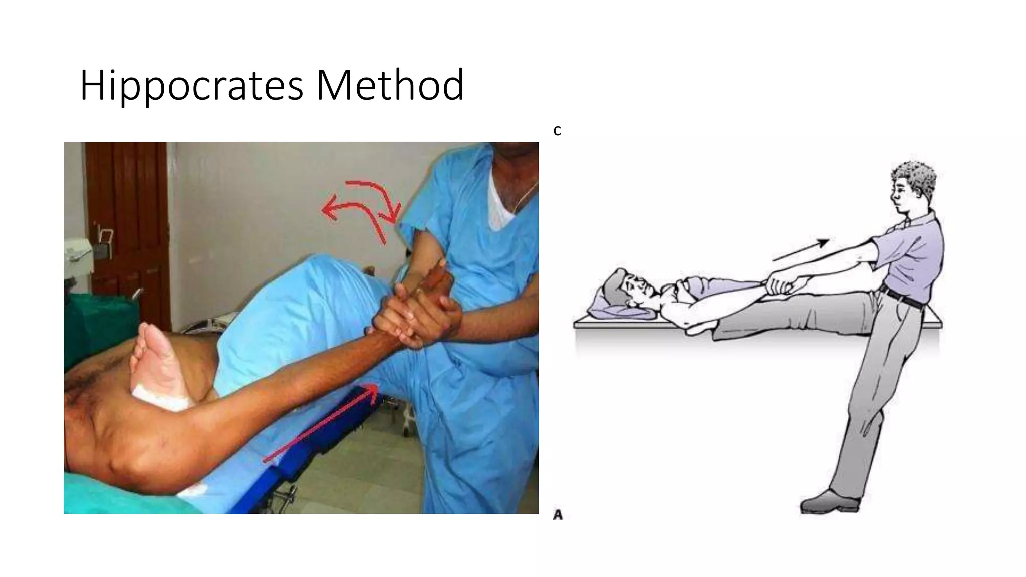 Hippocrates Method
c
 