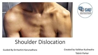 Shoulder Dislocation
Created by-Vaibhav Kushwaha
Tabish Parkar
Guided By Dr.Hashini Karunadhara
 