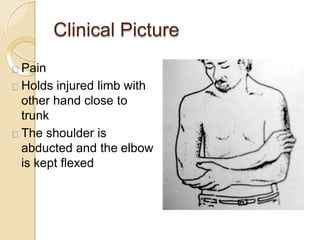 Clinical Picture
Pain
Holds injured limb with
other hand close to
trunk
The shoulder is
abducted and the elbow
is kept flexed
 