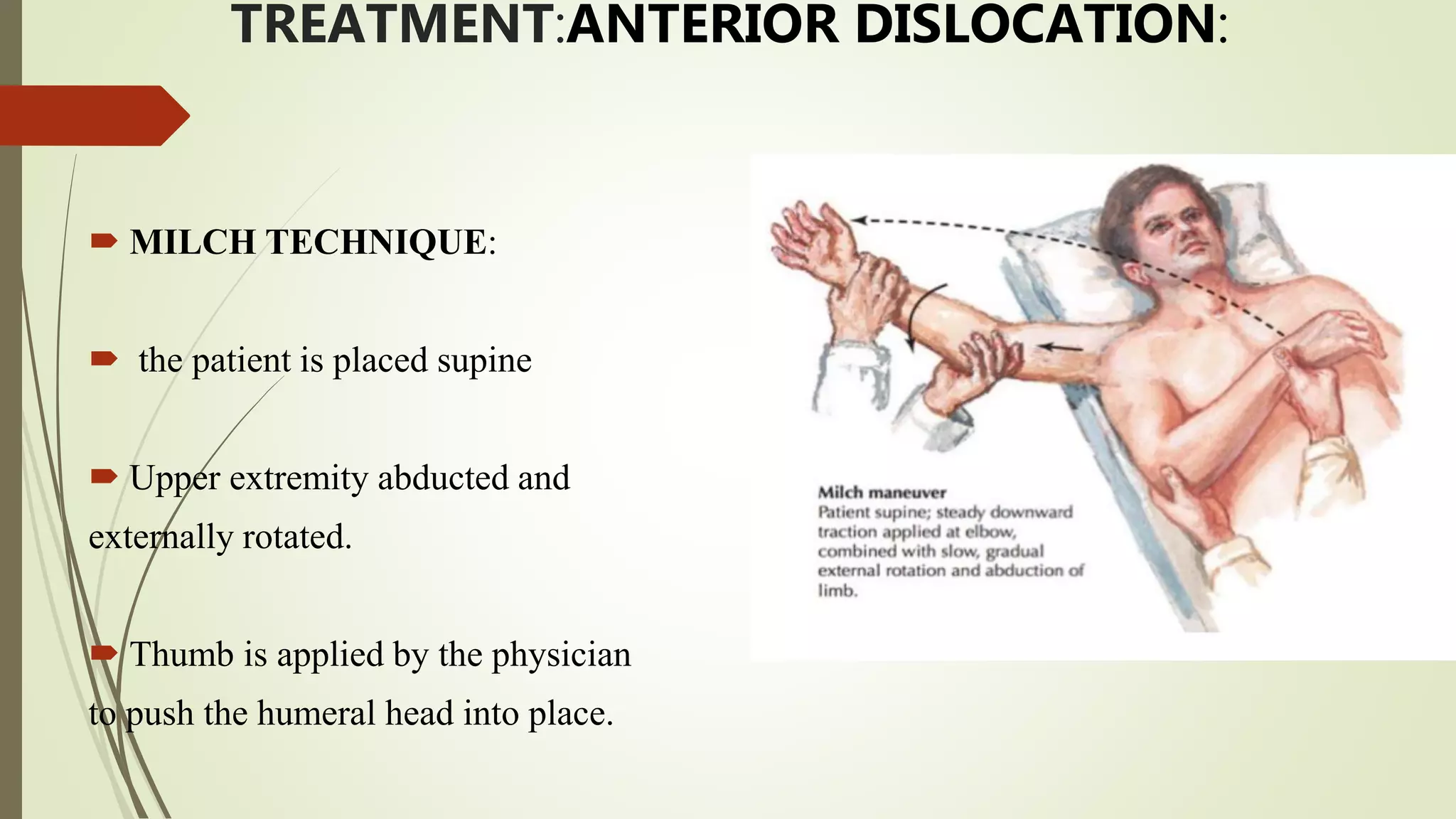 Shoulder Reduction Methodes Shoulder dislocation | PPTX