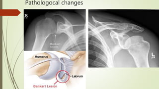 Pathologocal changes
 