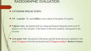 RADIOGRAPHIC EVALUATION
 ANTERIOR DISLOCATION:
 AP , scapular –Y, and axillary views taken in the plane of scapula.
 Velpeau view: the patient left in a sling and leaned obliquely backward 45
degrees over the cassette. A the beam is directed caudally, orthogonal to the
cassette.
 west point view: the patient with prone and the beam directed cephalad to the
axila 25 degrees from the horizontal and 25 degrees medial.( Bankert lesion)
 